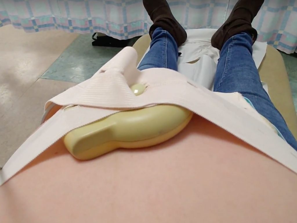 Monitoring Lydia at the maternity unit