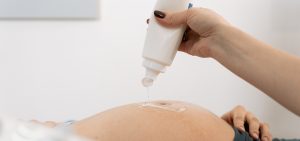 Skin changes during pregnancy
