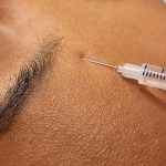 Summer beauty guide: tips to help you get natural-looking botox