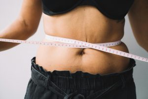 The differences between a mini tummy tuck and a full tummy tuck