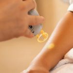 How can laser hair removal treatment help manage hormonal hair issues