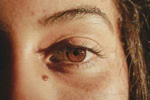 How to identify an itchy mole: signs to look for