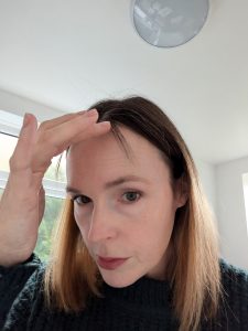 Showing hair regrowth