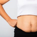 Improve your post-pregnancy look: 7 key cosmetic options