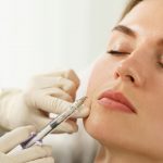 Can Radiesse be reversed?