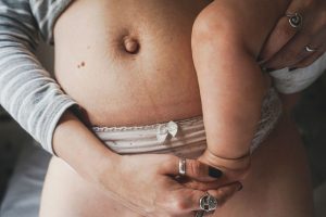 Body Enhancements for New Mums: Simple Solutions to Boost Your Confidence