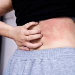 Exploring the Challenges of Diagnosing and Treating Remote Rare Diseases