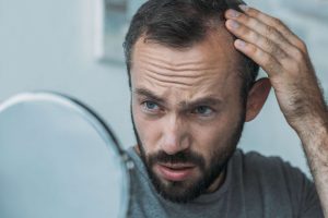 11 Tips for Combating Hair Loss