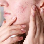 Why You Need a Pore-Clogging Ingredients Checker in Your Skincare Routine