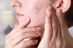 Why You Need a Pore-Clogging Ingredients Checker in Your Skincare Routine
