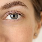Everything You Need to Know About Brow Lifts