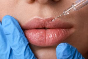 Cosmo Direct Supply: Your Trusted Source for Beauty and Aesthetic Products, Including Dermal Fillers