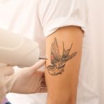 How Tattoo Removal Can Improve Your Mental Health and Confidence