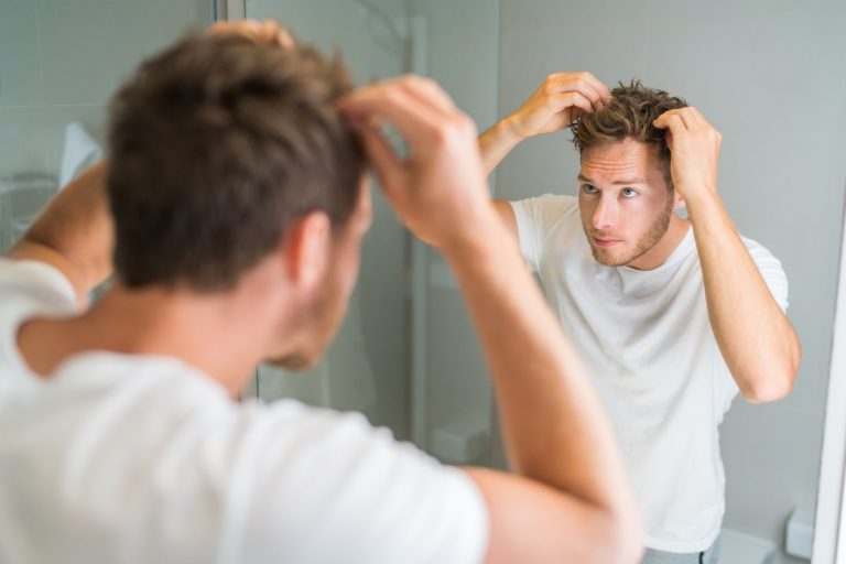 Winning the Battle Against Hair Loss: Smart Solutions for Modern Men Winning the Battle Against Hair Loss: Smart Solutions for Modern Men