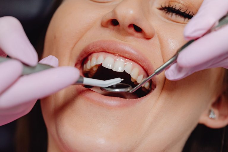 Dental Implants: A Complete Guide