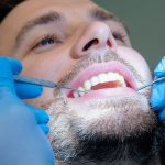 Fixing Your Smile the Smart Way: Steps That Actually Help