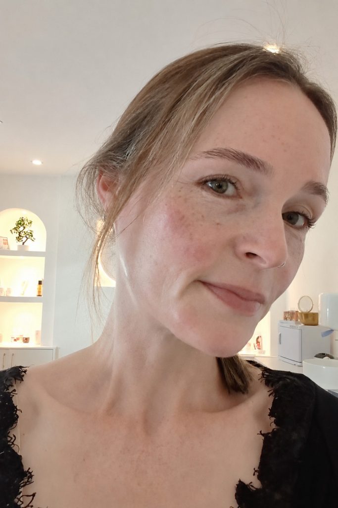 Immediately after treatment