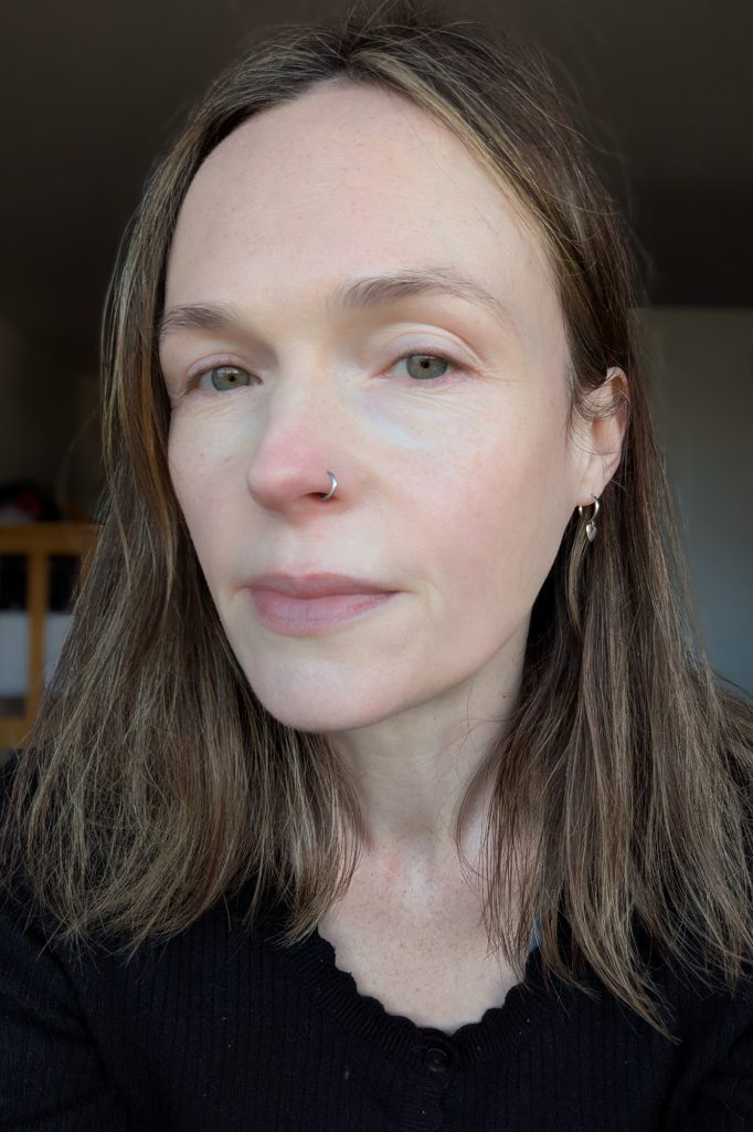 Before treatment, no makeup, inside
