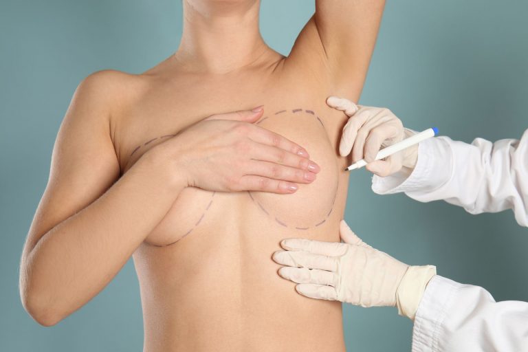 5 Top-Rated Breast Augmentation Surgeons in Toronto