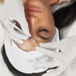 Micro-Botox: The Latest Trend in Boca Raton Aesthetic Medicine