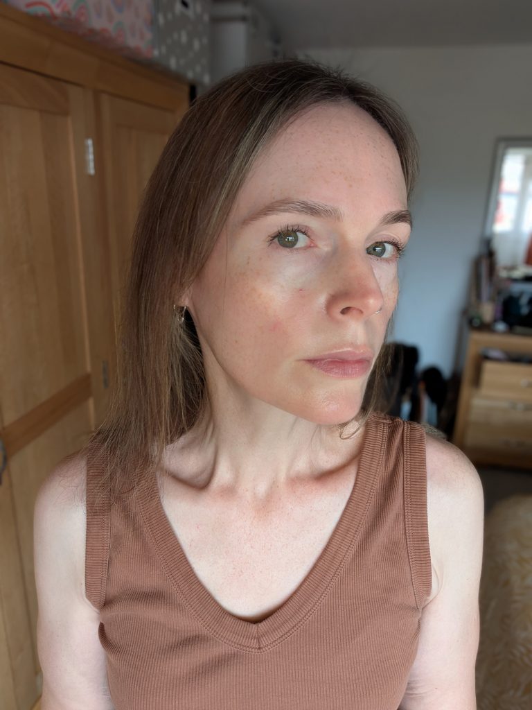 Two weeks, no makeup, right-hand side