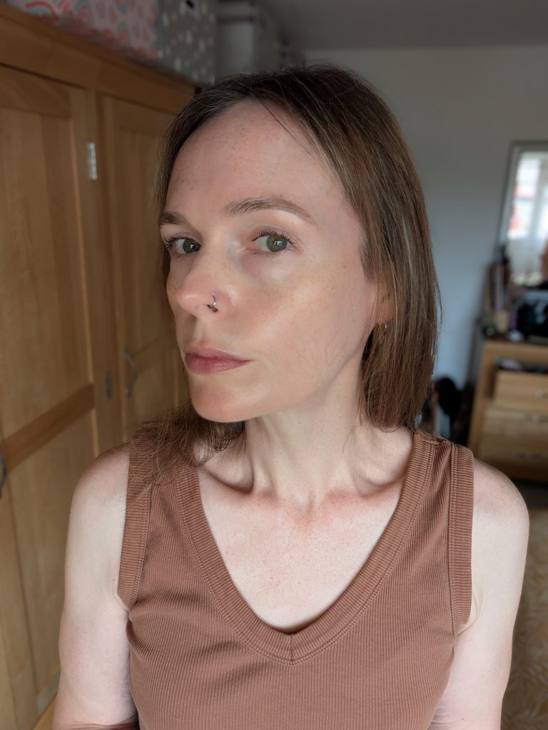 Two weeks, no makeup, left-hand side