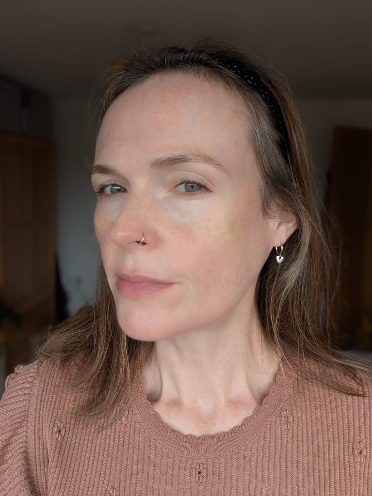 Three weeks, no makeup, left-hand side