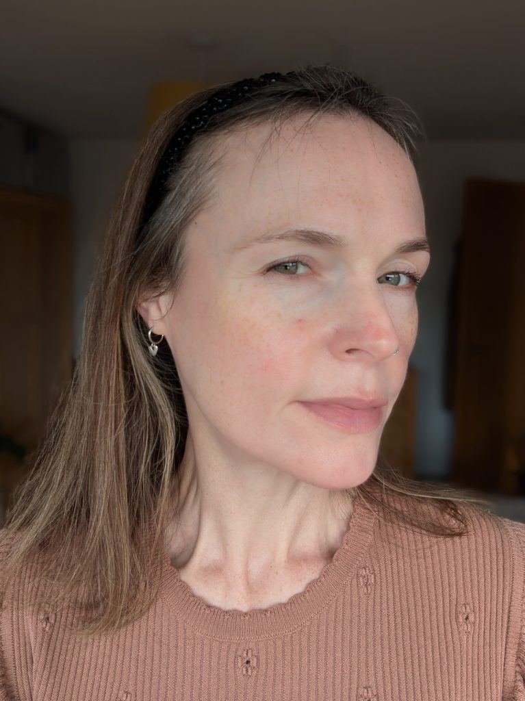 Three weeks, no makeup, right-hand side