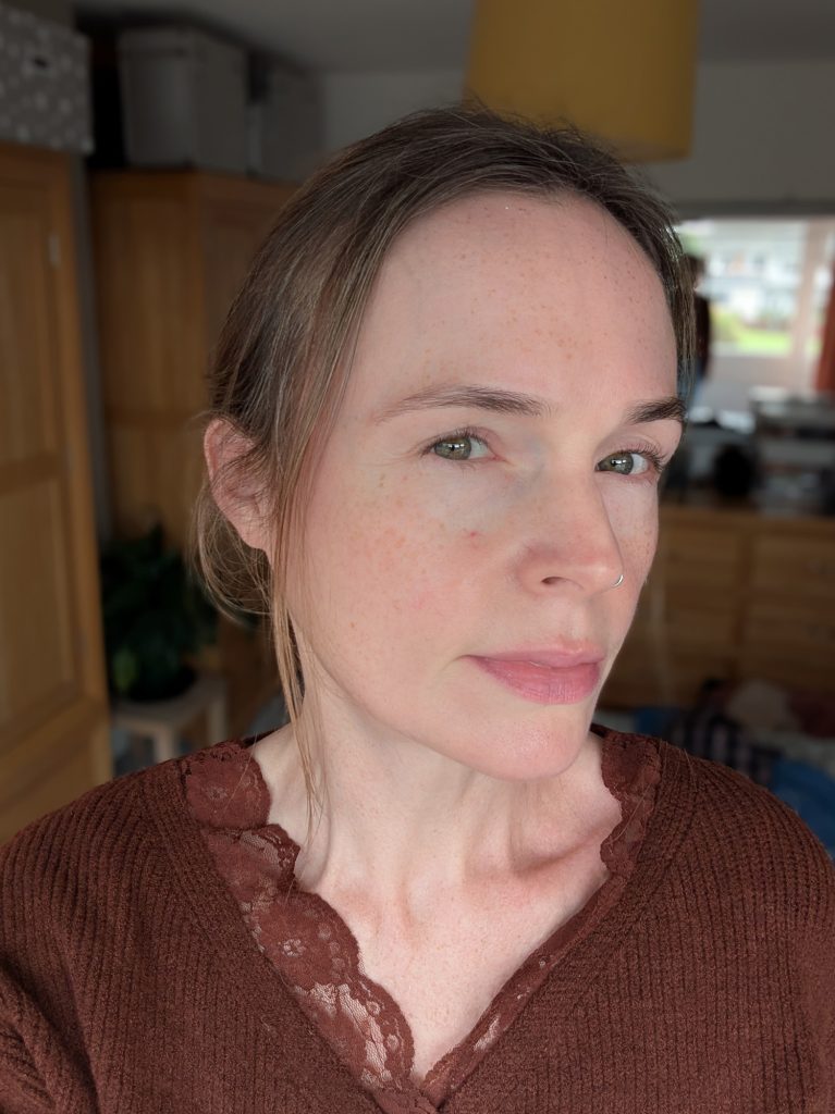 Five weeks, no makeup, right-hand side