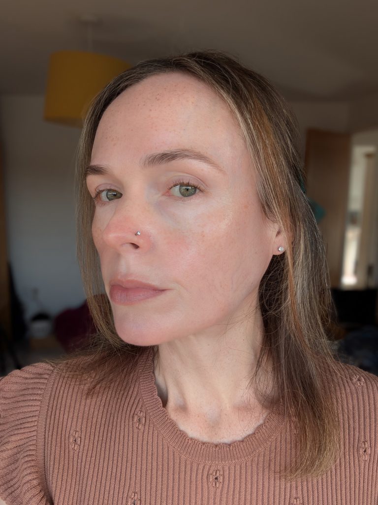 Six weeks, no makeup, left-hand side