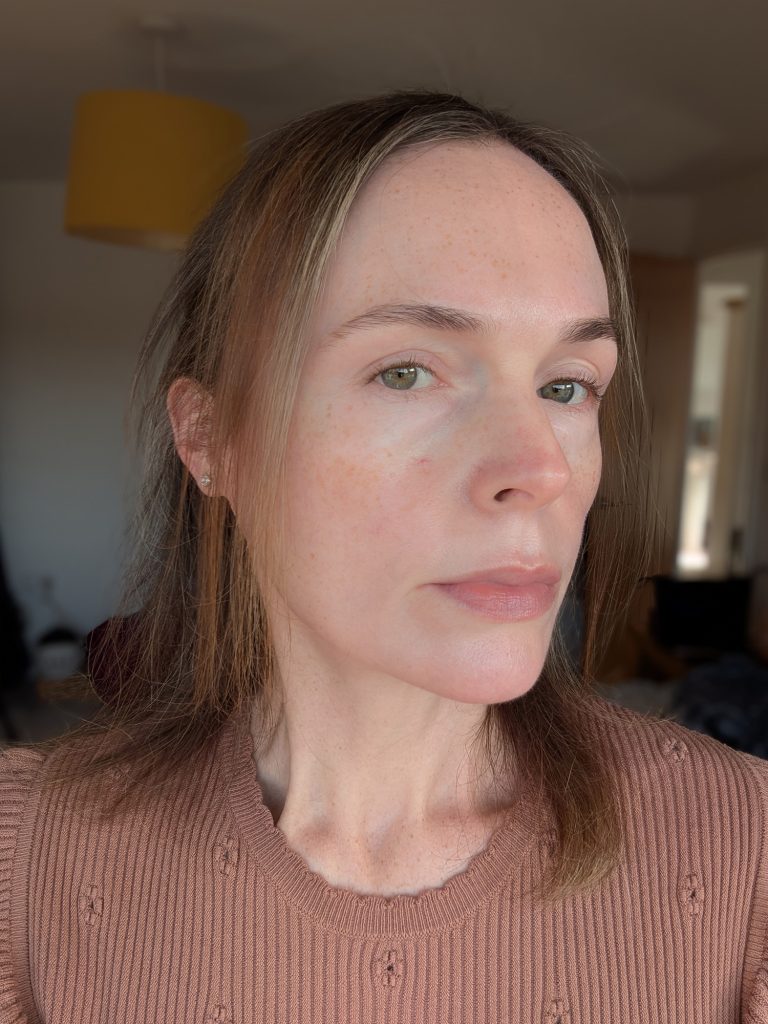 Six weeks, no makeup, right-hand side