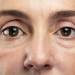 Can You Prevent Hooded Eyelids and Other Signs of Ageing Around the Eyes?