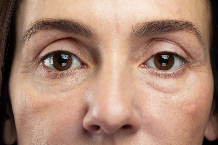 Can You Prevent Hooded Eyelids and Other Signs of Ageing Around the Eyes? Can You Prevent Hooded Eyelids and Other Signs of Ageing Around the Eyes?
