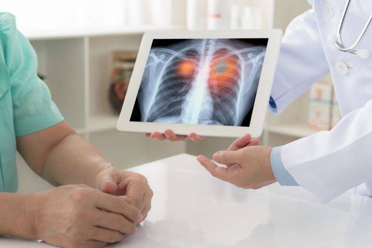 Bronchitis in the Family: Acute vs. Chronic and Who’s at Risk Bronchitis in the Family: Acute vs. Chronic and Who's at Risk